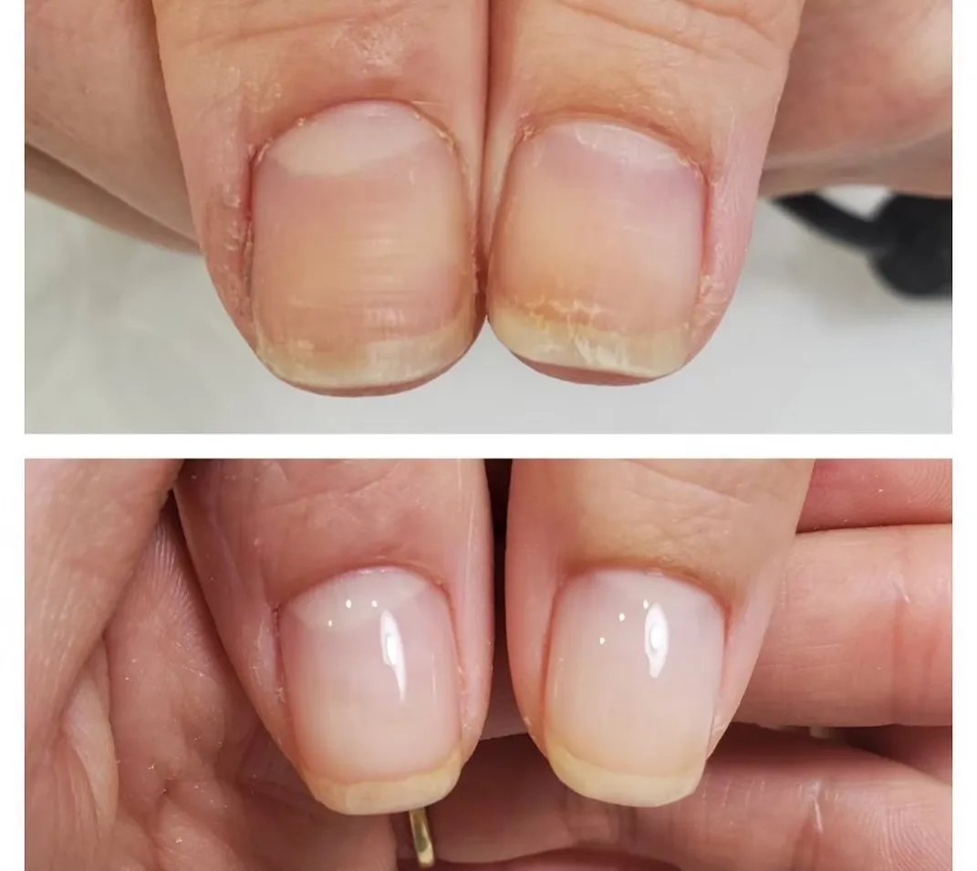 【横浜市鶴見区　自爪育成ネイルサロンミアリ】