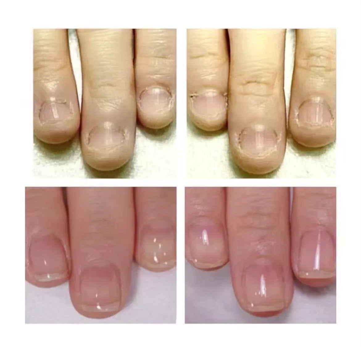 横浜市鶴見区自爪育成ネイルサロンミアリの写真です