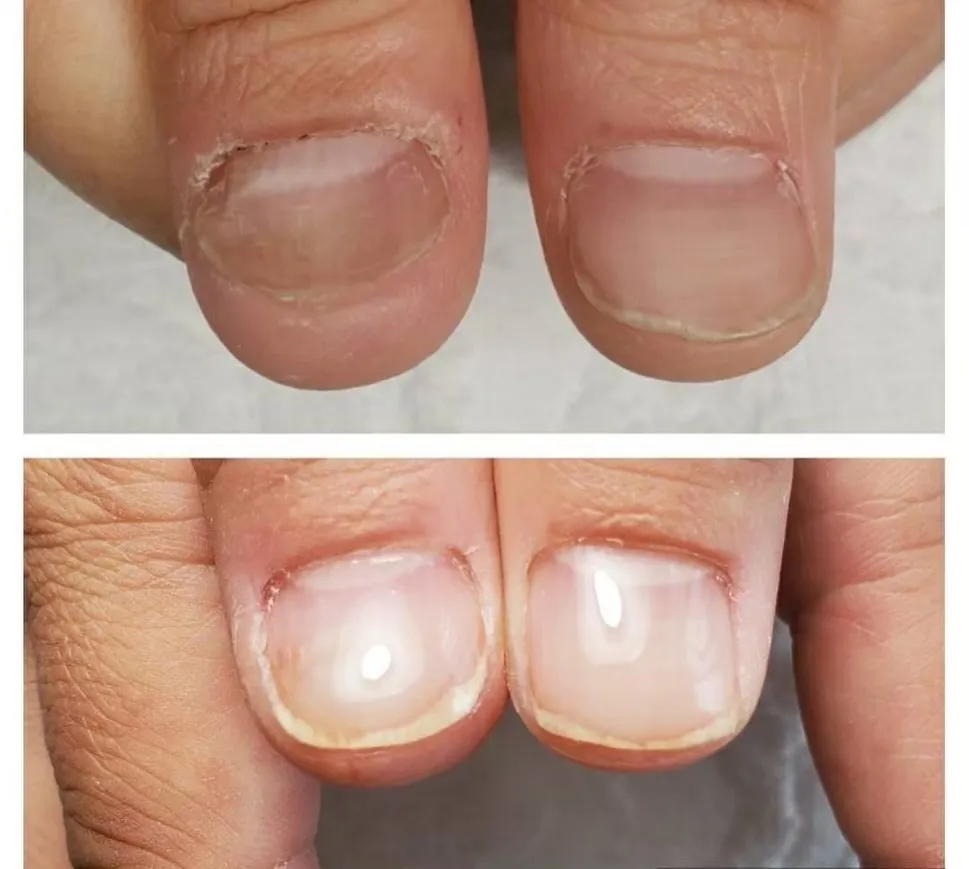 【横浜市鶴見区自爪育成ネイルサロンミアリ】