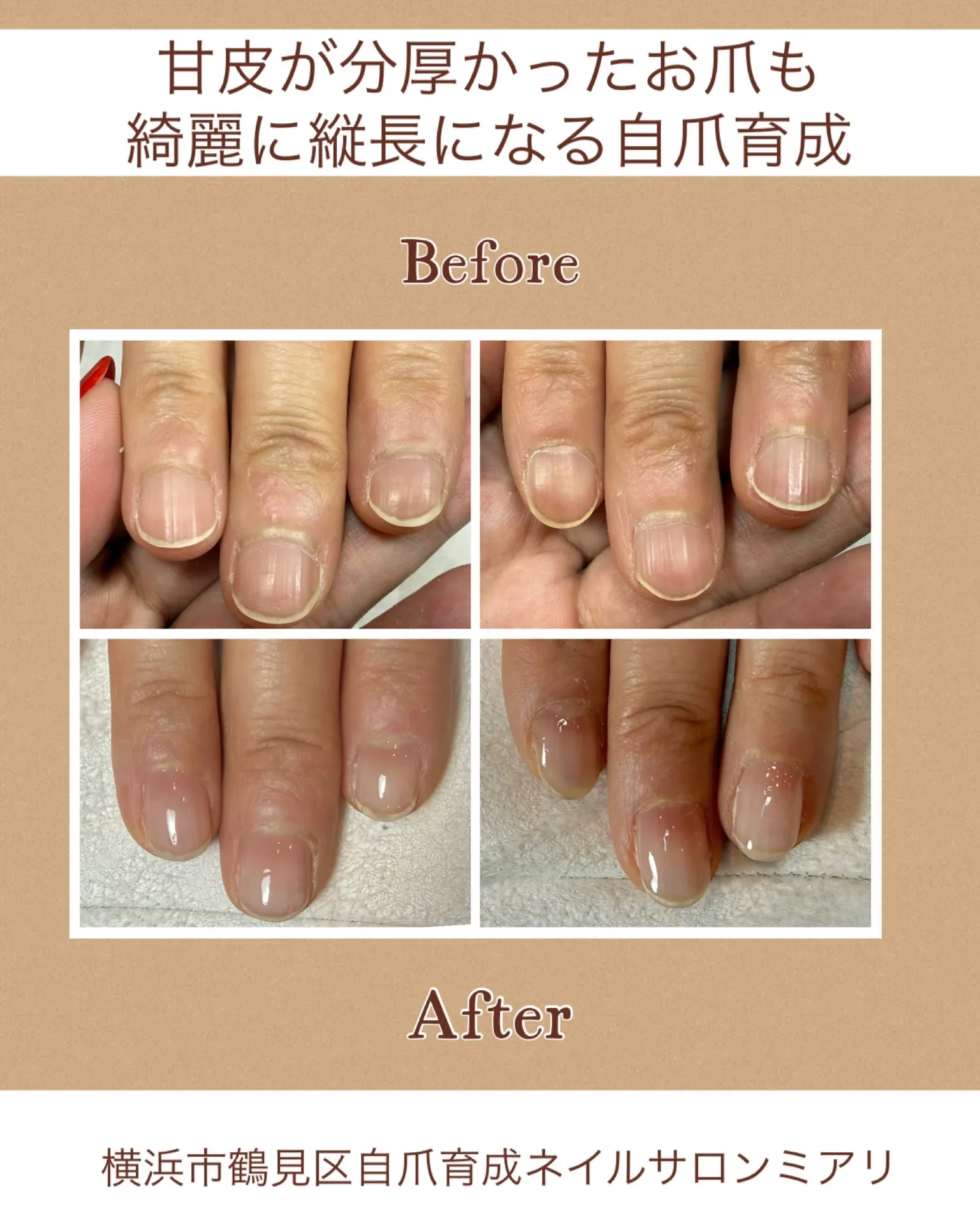 【国道駅/横浜市鶴見区自爪育成ネイルサロンミアリ】