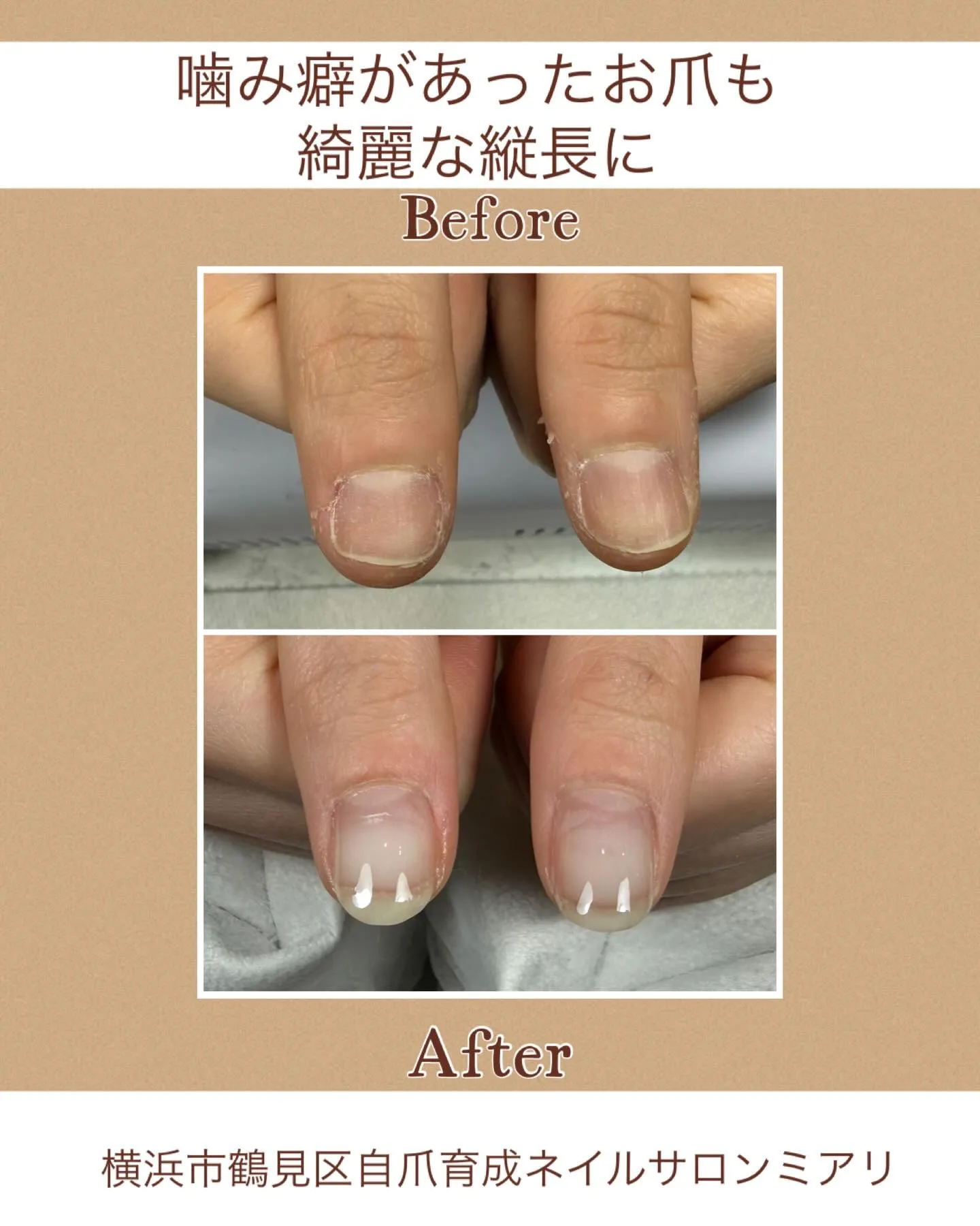 【国道駅/横浜市鶴見区自爪育成ネイルサロンミアリ】