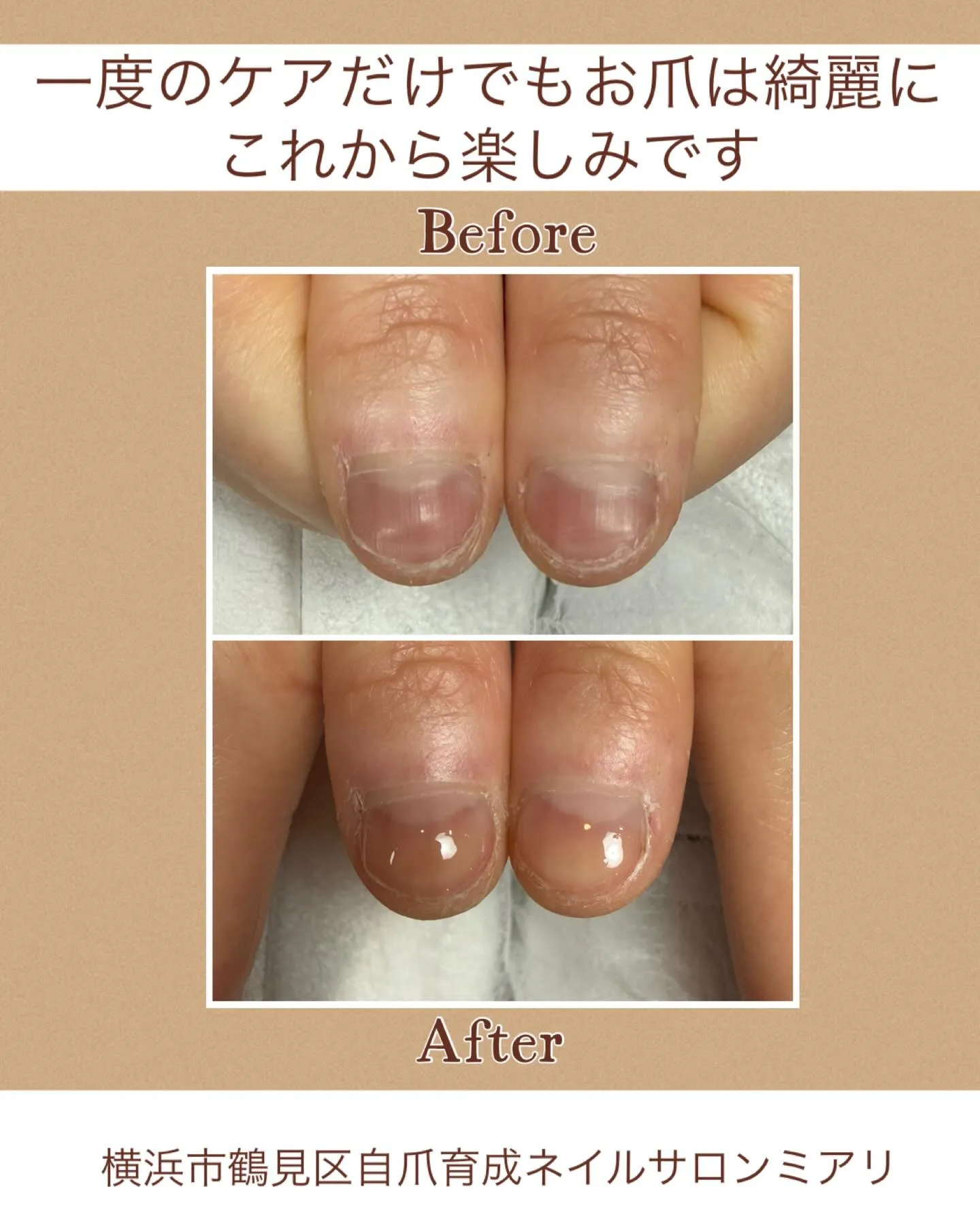 【国道駅/横浜市鶴見区自爪育成ネイルサロンミアリ】
