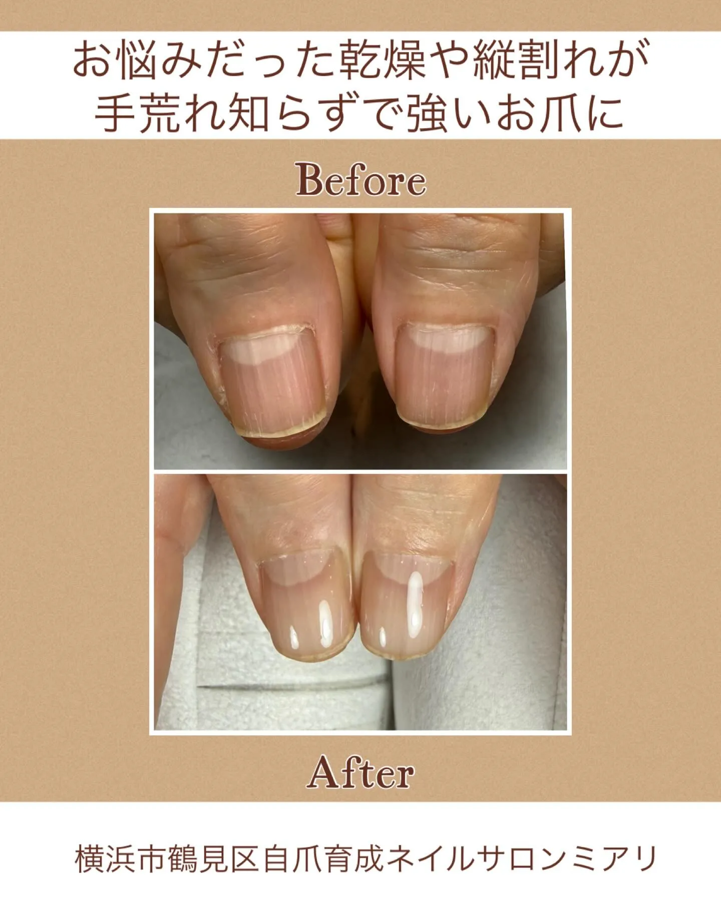 【国道駅/横浜市鶴見区自爪育成ネイルサロンミアリ】