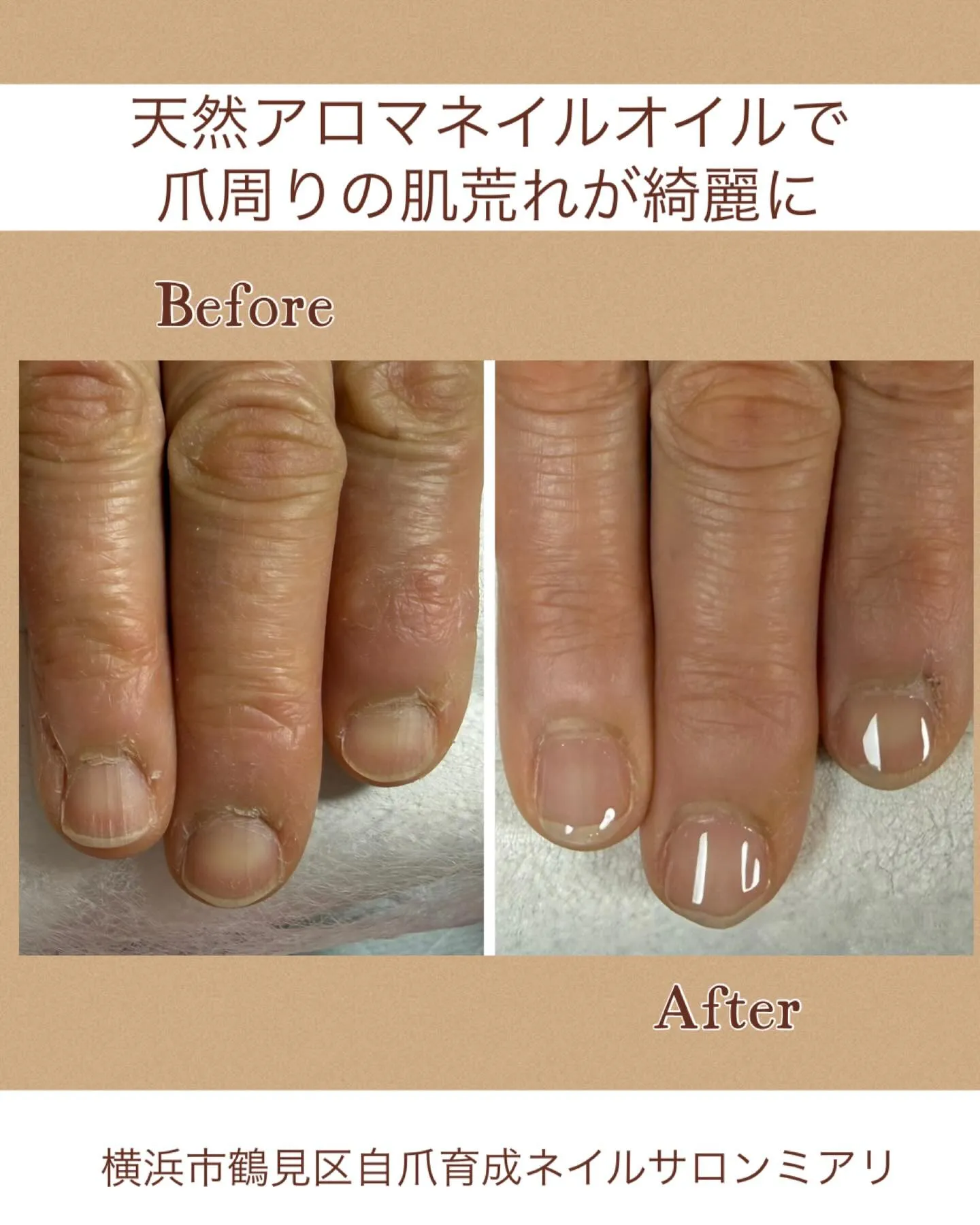 【国道駅/横浜市鶴見区自爪育成ネイルサロンミアリ】