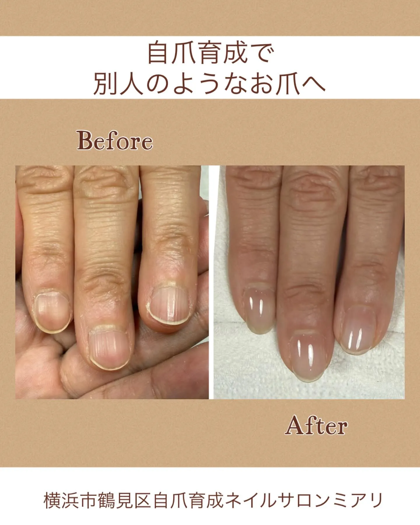 【国道駅/横浜市鶴見区自爪育成ネイルサロンミアリ】