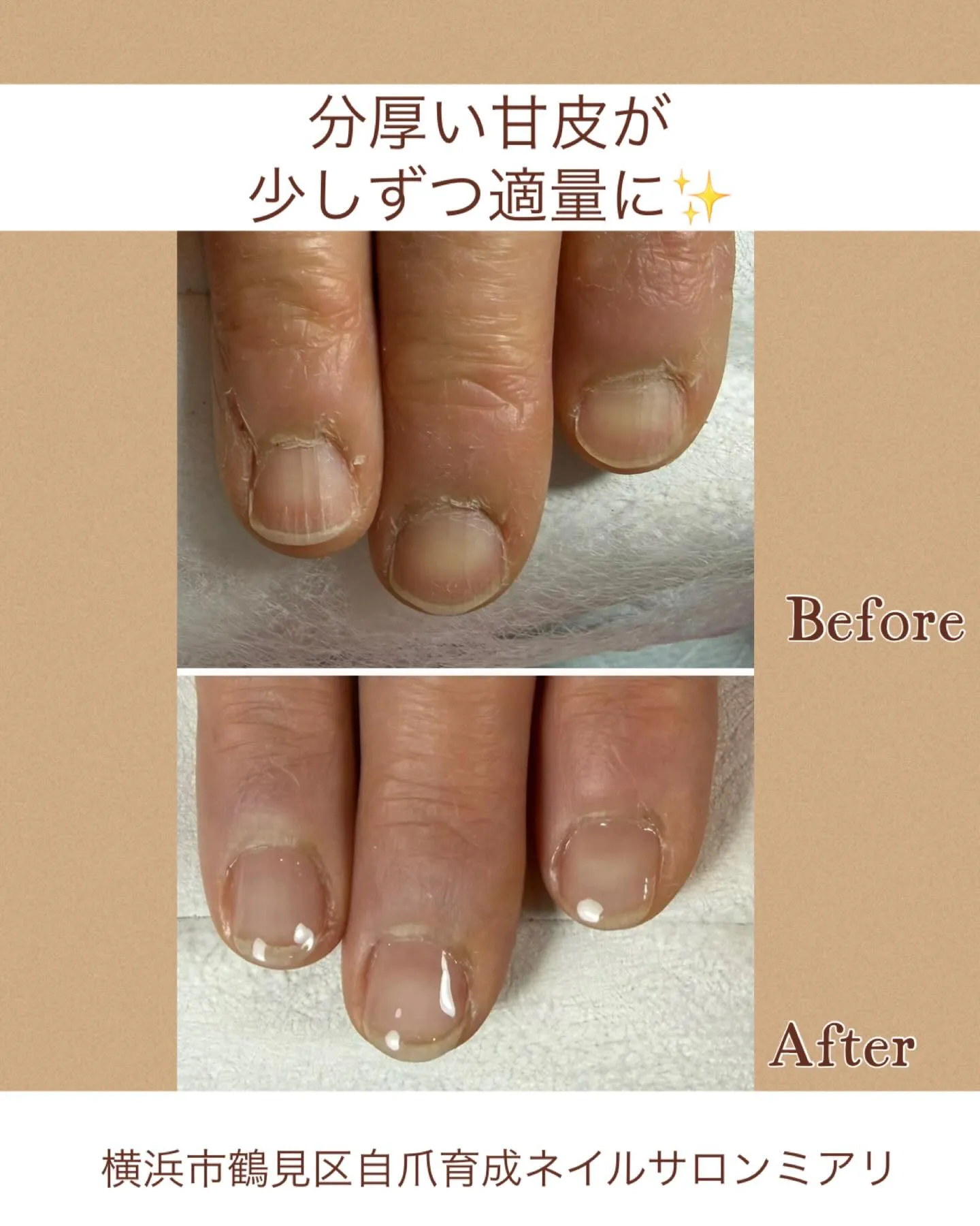 【国道駅/横浜市鶴見区自爪育成ネイルサロンミアリ】