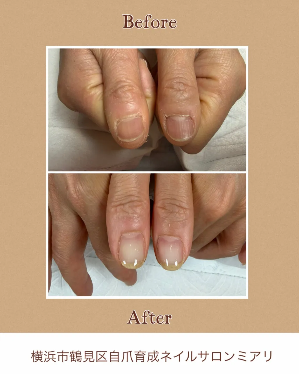 🌿 自爪育成 Before → After 🌿